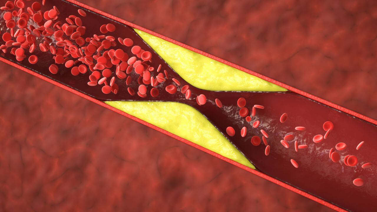 Understanding Leg Pain Common Causes And Treatment Options understanding-leg-pain-common-causes-and-treatment-options